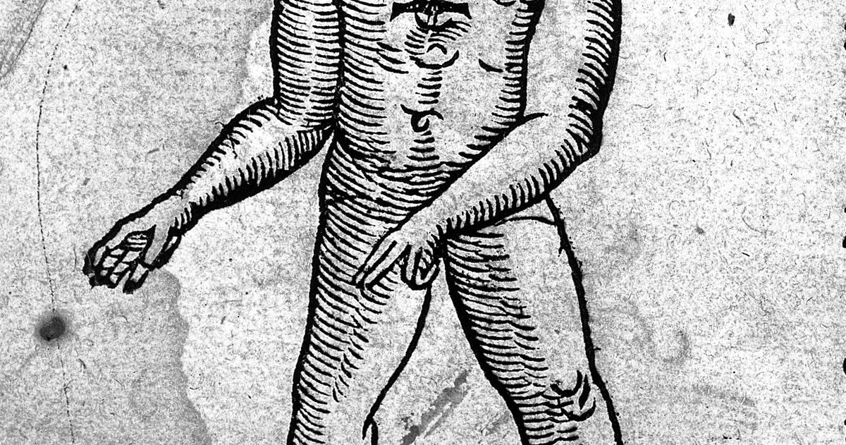 ‘Image of a blemmyes’ from Prodigiorum ac ostentorum chronicon (1557 ...