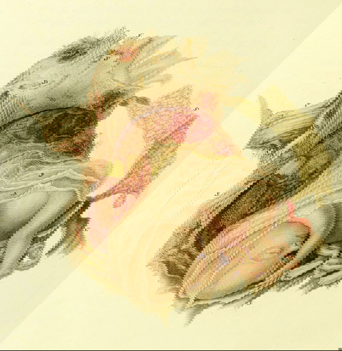 19th-century illustration of miscarriage