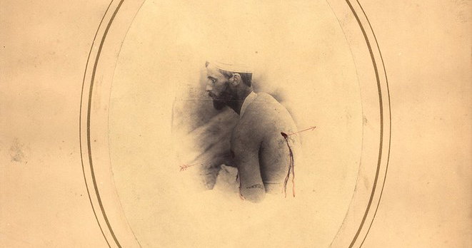 Colonel Donham ‘William A Donan , a 26-year-old sergeant, wounded on June 3rd, 1864 ...