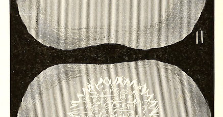 ‘The “pericentral spectrum” of Mr. Beck’ from Subjective Sensations of Sight and Sound (1904)